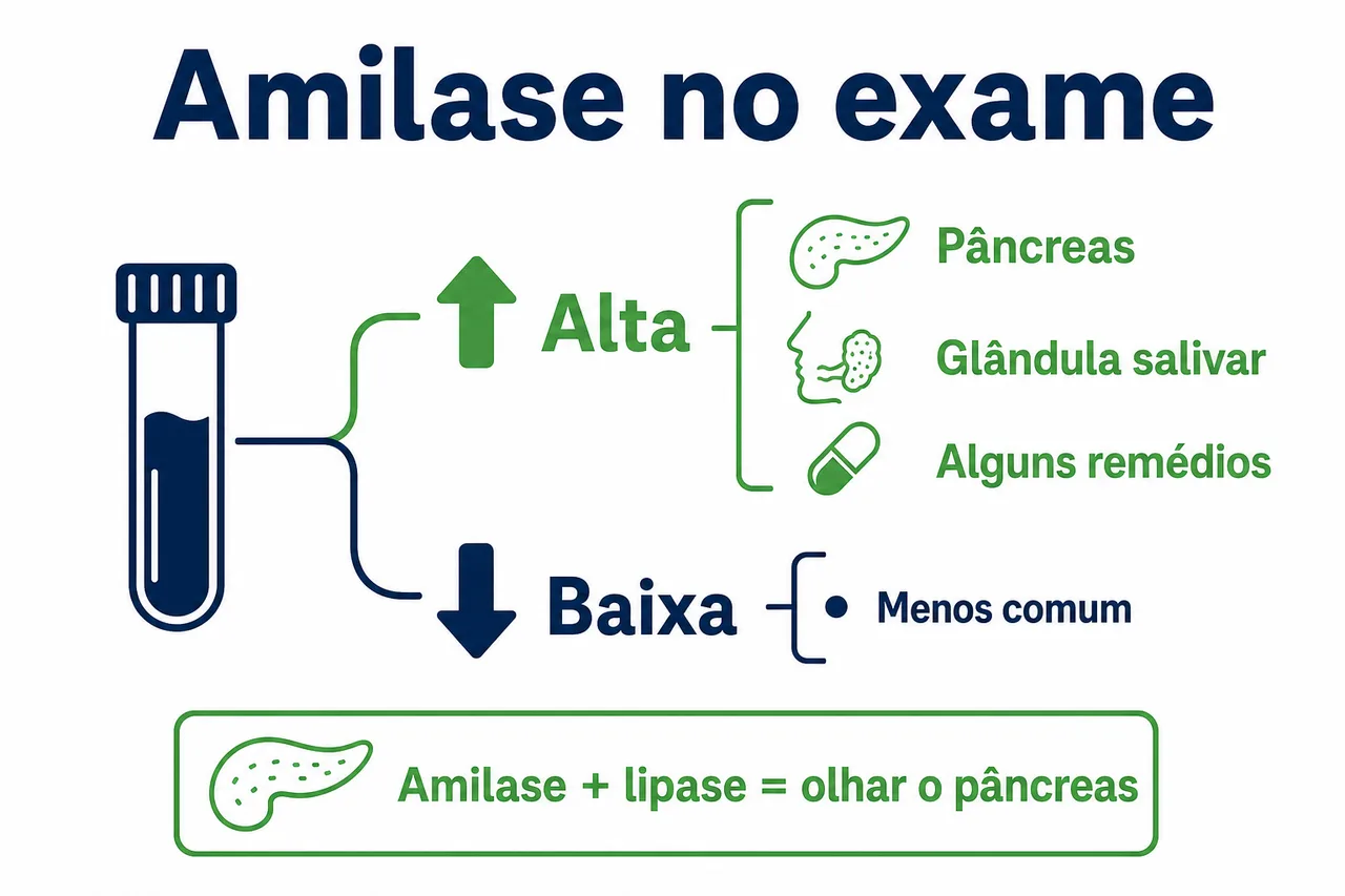 Infográfico simples sobre a leitura do exame de amilase, com uma seta para cima indicando amilase alta e suas causas, uma seta para baixo indicando amilase baixa, e a nota de que amilase com lipase aponta para o pâncreas
