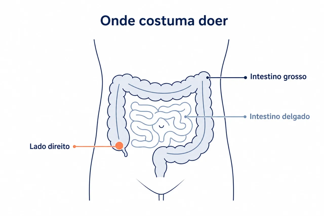 Mapa simples do abdômen mostrando em que região costuma doer cada parte do intestino