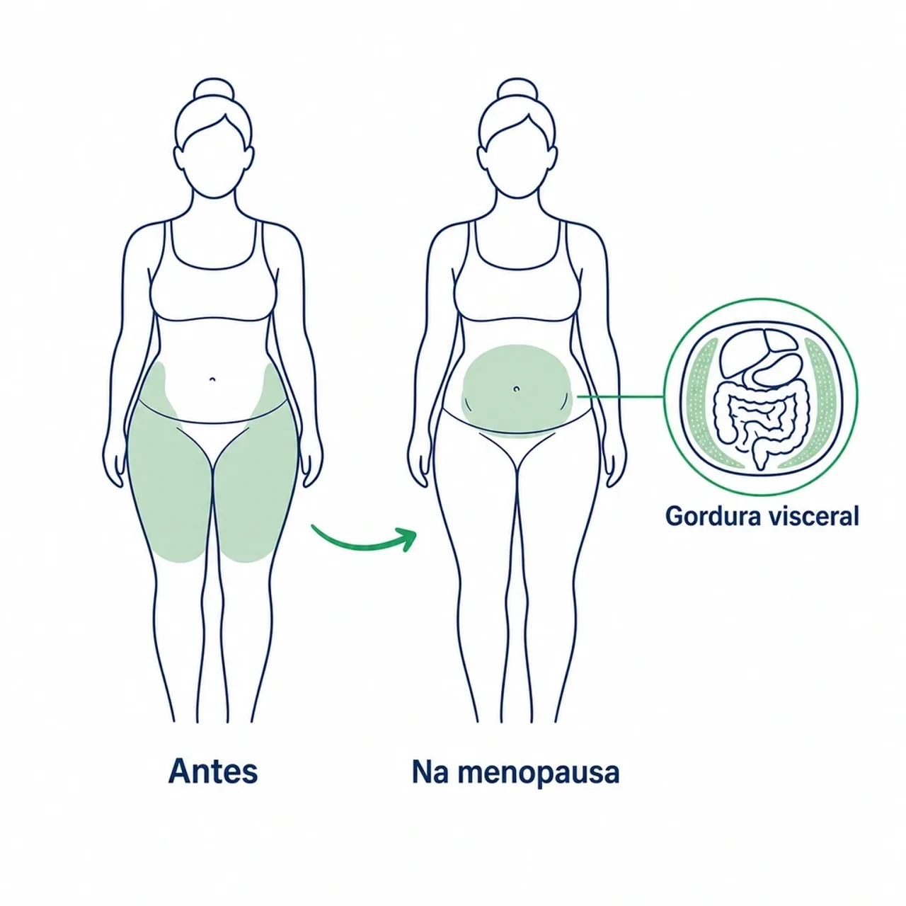 Ilustração explicando a redistribuição da gordura na menopausa, do quadril para a região abdominal, com destaque para a gordura visceral ao redor dos órgãos