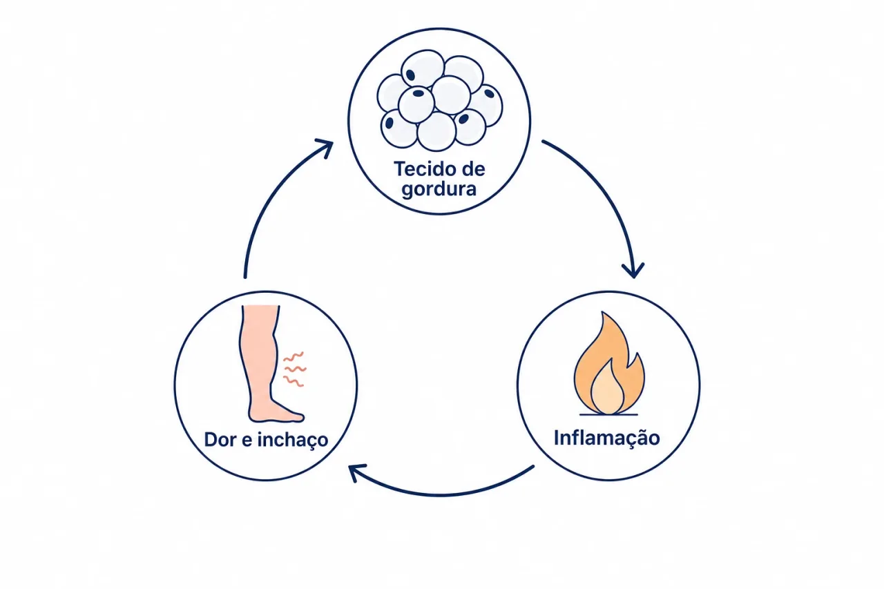 Ilustração do ciclo do lipedema: tecido de gordura, inflamação e dor se reforçando
